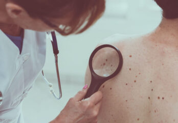 skin_cancer_check skin_cancer_check